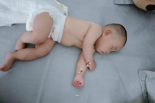 平湖宝宝脸上有白色斑块